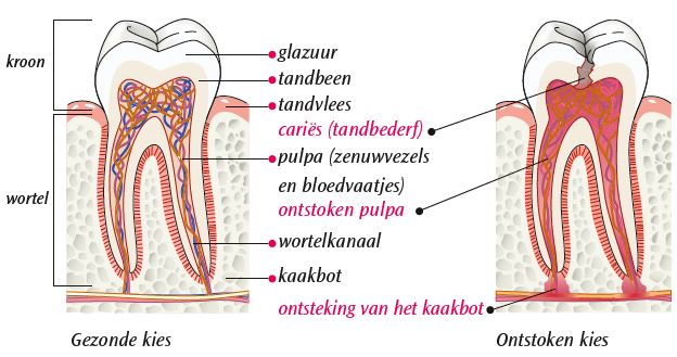 Endo 2